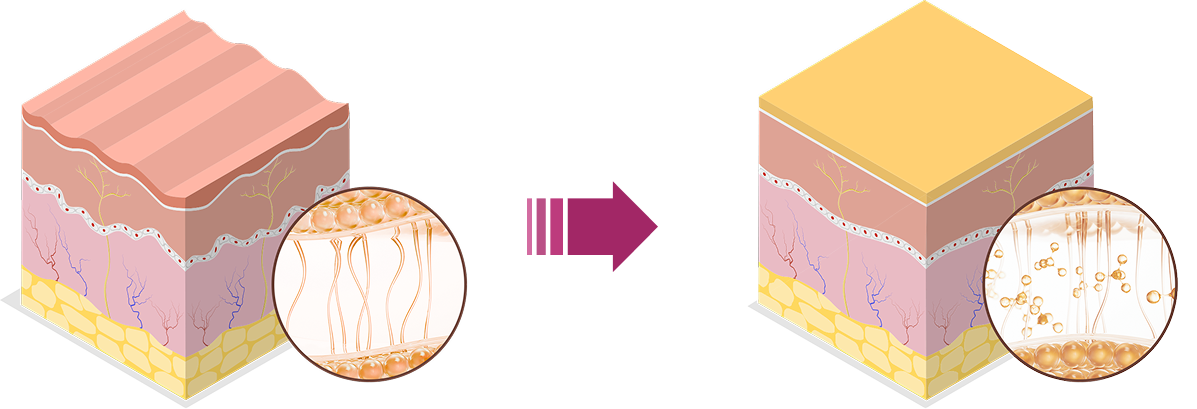 스컬트라 원리 PC