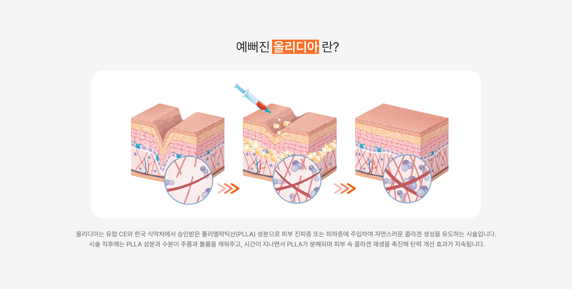 올리디아 이미지 2