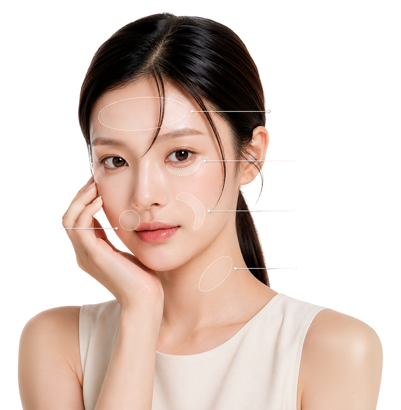 리쥬란 얼굴 시술 부위