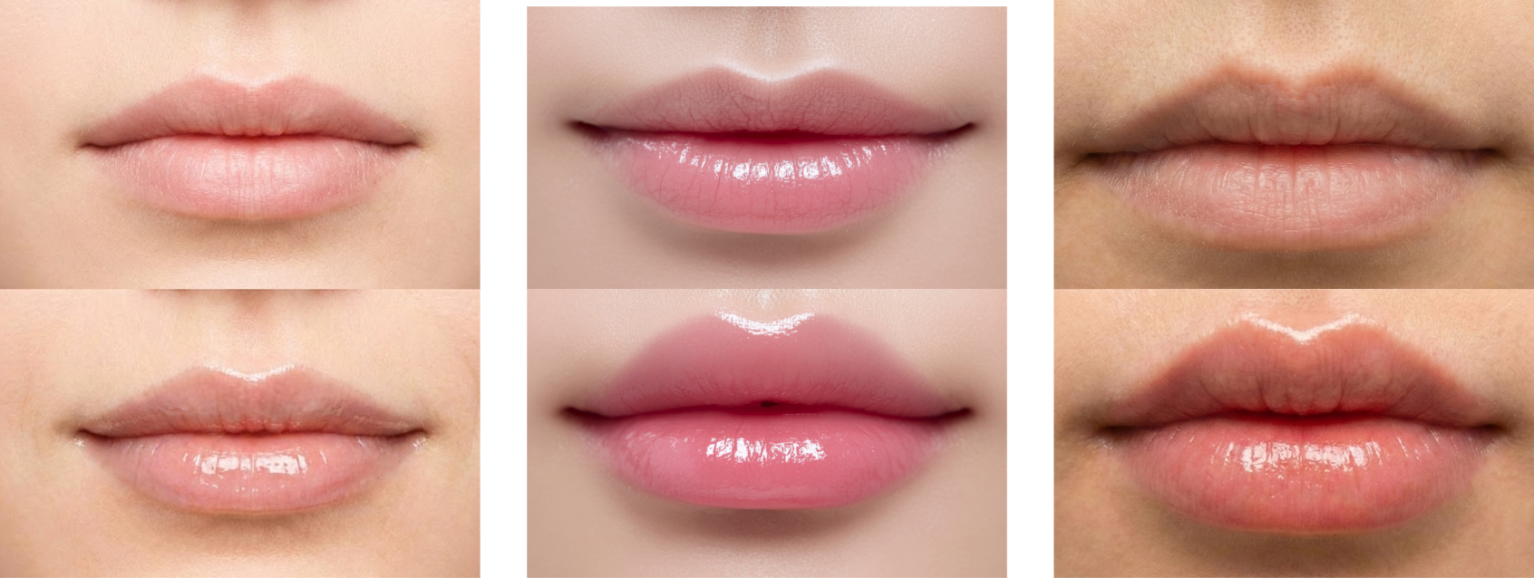 플럼필 입술 이미지