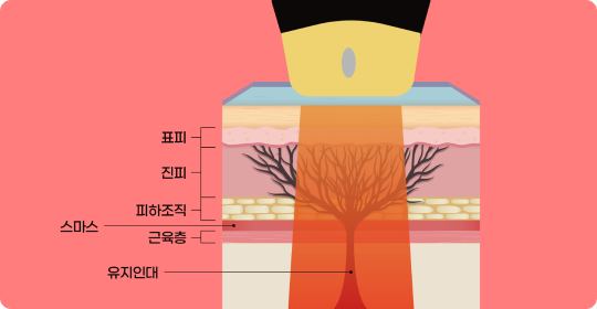 STACK MODE 진피층 이미지